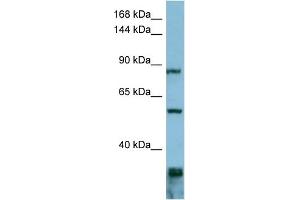 WB Suggested Anti-EPS8  Antibody Titration: 0. (EPS8 anticorps  (Middle Region))