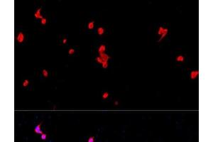 Immunofluorescence analysis of PC-12 cells using EIF2S1 Polyclonal Antibody at dilution of 1:100.