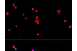 Immunofluorescence analysis of PC-12 cells using EIF2S1 Polyclonal Antibody at dilution of 1:100. (EIF2S1 anticorps)