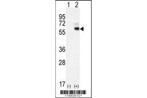 Western blot analysis of KNG1 using rabbit polyclonal KNG1 Antibody using 293 cell lysates (2 ug/lane) either nontransfected (Lane 1) or transiently transfected (Lane 2) with the KNG1 gene. (KNG1 anticorps  (N-Term))