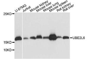 Western blot analysis of extracts of various cell lines, using UBE2L6 antibody. (UBE2L6 anticorps  (C-Term))