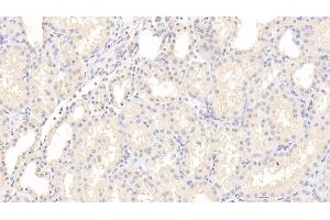 Detection of INSR in Human Kidney Tissue using Polyclonal Antibody to Insulin Receptor (INSR)