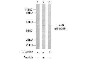 Image no. 2 for anti-Jun B Proto-Oncogene (JUNB) (pSer259) antibody (ABIN196659) (JunB anticorps  (pSer259))