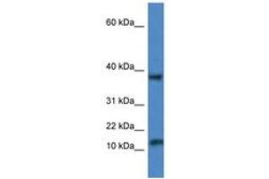 Image no. 1 for anti-Vesicle-Associated Membrane Protein 1 (Synaptobrevin 1) (VAMP1) (AA 53-102) antibody (ABIN6747255) (VAMP1 anticorps  (AA 53-102))