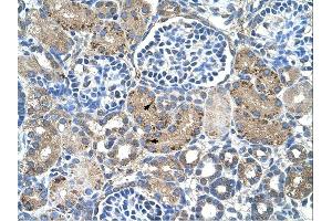 GLS2 antibody was used for immunohistochemistry at a concentration of 4-8 ug/ml.