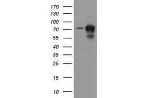 Western Blotting (WB) image for anti-Pseudouridylate Synthase 7 Homolog (PUS7) antibody (ABIN1500515) (PUS7 anticorps)