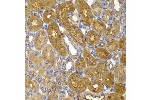 Immunohistochemistry of paraffin-embedded rat kidney using PRKAB1 antibody (ABIN5995401) at dilution of 1/100 (40x lens). (PRKAB1 anticorps)