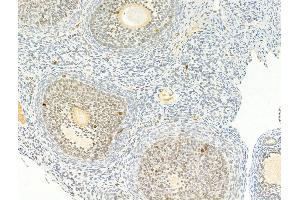 ABIN6256592 and ABIN6267253 at 1/100 staining Rat ovary tissue by IHC-P.