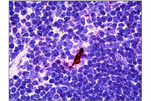 Immunohistochemistry (IHC) image for anti-Interleukin-27 subunit beta (IL-27b) antibody (ABIN781990) (EBI3 anticorps)