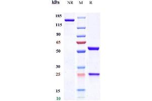 Anti-SOST / Sclerostin Reference Antibody (blosozumab) on SDS-PAGE under reducing (R) condition.