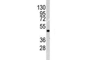 Western blot analysis of ILK1 antibody and NCI-H460 lysate.