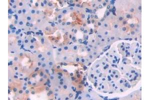 Detection of LCAT in Rat Kidney Tissue using Polyclonal Antibody to Lecithin Cholesterol Acyltransferase (LCAT) (LCAT anticorps  (AA 41-210))