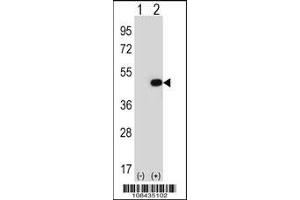 Western blot analysis of EIF2B3 using rabbit polyclonal EIF2B3 Antibody using 293 cell lysates (2 ug/lane) either nontransfected (Lane 1) or transiently transfected (Lane 2) with the EIF2B3 gene.