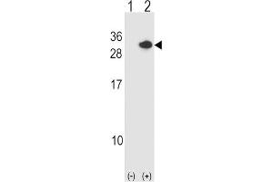 Western Blotting (WB) image for anti-Regulator of Calcineurin 1 (RCAN1) antibody (ABIN2998994)