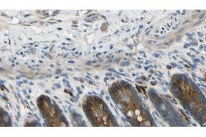 ABIN6274601 at 1/100 staining Mouse intestine tissue by IHC-P. (CDH22 anticorps  (N-Term))