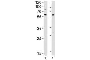 Western blot analysis of lysate from 1) Raji and 2) Ramos cell lines using LYN antibody at 1:1000.