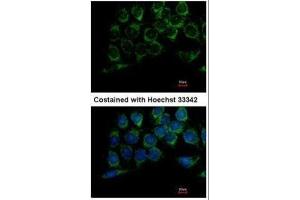 ICC/IF Image Immunofluorescence analysis of methanol-fixed Hep3B, using DLD, antibody at 1:100 dilution. (DLD anticorps)