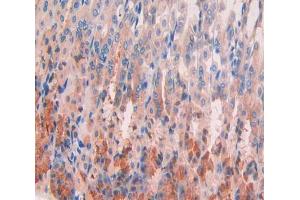Used in DAB staining on fromalin fixed paraffin- embedded stomach tissue (GPC4 anticorps  (AA 220-426))