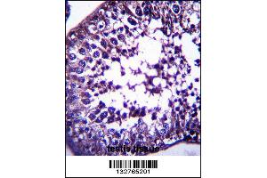 TSPYL5 Antibody immunohistochemistry analysis in formalin fixed and paraffin embedded human testis tissue followed by peroxidase conjugation of the secondary antibody and DAB staining. (TSPYL5 anticorps  (C-Term))