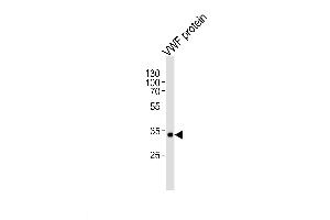 Lane 1: VWF protein, probed with VWF (907CT12. (VWF anticorps)