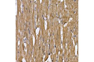 Immunohistochemistry of paraffin-embedded rat heart using [KO Validated] ST Rabbit pAb (ABIN6132553, ABIN6148568, ABIN6148571 and ABIN6215503) at dilution of 1:250 (40x lens).