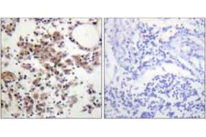 Immunohistochemistry analysis of paraffin-embedded human lymph node, using SYK (Phospho-Tyr323) Antibody.