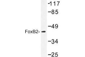 Image no. 1 for anti-Forkhead Box B2 (FOXB2) antibody (ABIN317907) (FOXB2 anticorps)