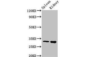 Western Blot Positive WB detected in: Mouse spleen tissue, Mouse kidney tissue All lanes: ABT1 antibody at 3 μg/mL Secondary Goat polyclonal to rabbit IgG at 1/50000 dilution Predicted band size: 32 kDa Observed band size: 32 kDa (Activator of Basal Transcription 1 anticorps  (AA 197-270))