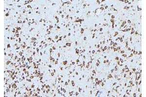 ABIN6279159 at 1/100 staining Mouse brain tissue by IHC-P. (ABCA3 anticorps  (Internal Region))