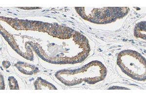 ABIN6279191 at 1/100 staining Human prostate tissue by IHC-P. (BAAT anticorps  (N-Term))