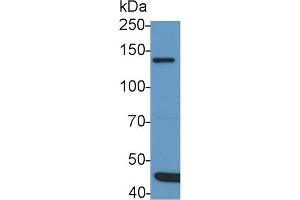 Detection of IRS1 in Rat Cerebrum lysate using Polyclonal Antibody to Insulin Receptor Substrate 1 (IRS1) (IRS1 anticorps  (AA 837-1089))
