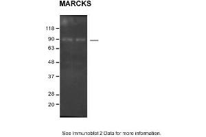 Sample: SH-SY5Y cells 2. (MARCKS anticorps  (C-Term))