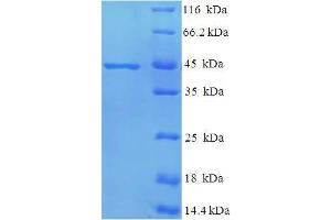 Mpt51 Gene Product (MPT51) (AA 27-299) protein (His tag) expressed in E. (MPT51 Protein (AA 27-299) (His tag))