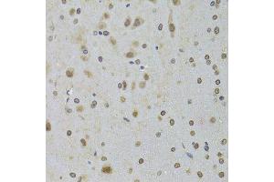 Immunohistochemistry of paraffin-embedded rat brain using DDX1 Antibody.