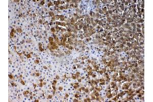 IHC analysis of PARK7 / DJ1 using anti-PARK7 / DJ1 antibody .