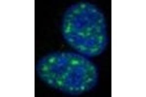 Immunofluorescence staining of HepG2 cells with ABIN7139623 at 1:100, counter-stained with DAPI.