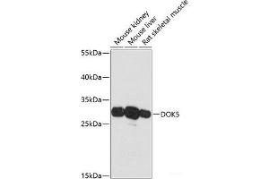 Western blot analysis of extracts of various cell lines using DOK5 Polyclonal Antibody at dilution of 1:3000. (DOK5 anticorps)