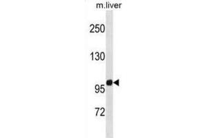 Western Blotting (WB) image for anti-Zinc Finger Protein 865 (ZNF865) antibody (ABIN5020901) (ZNF865 anticorps)