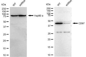 Western blotting analysis using CD97 antibody (ABIN7797989).