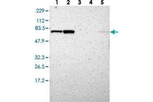 Western blot analysis of Lane 1: RT-4, Lane 2: U-251 MG, Lane 3: Human Plasma, Lane 4: Liver, Lane 5: Tonsil with RNGTT polyclonal antibody . (RNGTT anticorps)