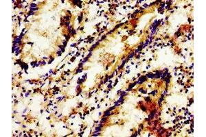 Immunohistochemistry of paraffin-embedded human appendix tissue using ABIN7158134 at dilution of 1:100