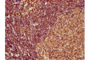 IHC image of ABIN7145992 diluted at 1:100 and staining in paraffin-embedded human lymph node tissue performed on a Leica BondTM system. (CCL27 anticorps  (AA 25-112))