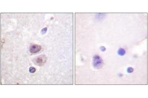 Immunohistochemistry analysis of paraffin-embedded human brain tissue, using p38 MAPK (Ab-322) Antibody.