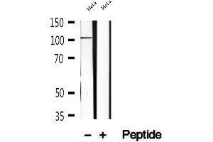 Western blot analysis of extracts of HeLa cells, using KIF18A antibody. (KIF18A anticorps  (Internal Region))