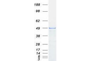 Validation with Western Blot