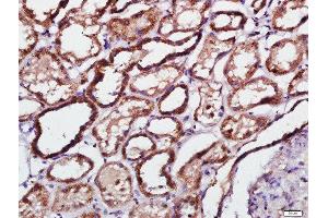 Paraformaldehyde-fixed, paraffin embedded human kidney tissue, Antigen retrieval by boiling in sodium citrate buffer(pH6) for 15min, Block endogenous peroxidase by 3% hydrogen peroxide for 30 minutes, Blocking buffer (normal goat serum) at 37°C for 20min, Antibody incubation with Rabbit Anti-PKR(Thr451) Polyclonal Antibody, Unconjugated  at 1:500 overnight at 4°C, followed by a conjugated secondary and DAB staining