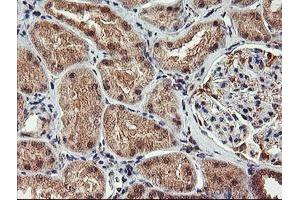 Immunohistochemical staining of paraffin-embedded Human Kidney tissue using anti-AGPAT5 mouse monoclonal antibody. (AGPAT5 anticorps)
