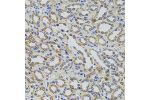 Immunohistochemistry of paraffin-embedded rat kidney using TRMT2A antibody (ABIN1877004) at dilution of 1:100 (40x lens). (TRMT2A anticorps)