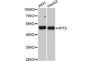 Western blot analysis of extracts of various cell lines, using IFIT2 antibody (ABIN6293343) at 1:3000 dilution.