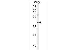Western blot analysis in WiDr cell line lysates (35ug/lane). (DUS4L anticorps  (AA 141-170))